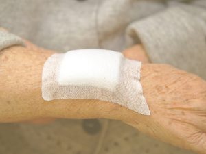 Las úlceras por presión o escaras son heridas o llagas que se forman en la piel y en el tejido que se encuentra bajo ella debido a la presión, roce o fricción. ¿Cómo detectarlas de forma precoz, prevenirlas y curarlas? En la imagen, vemos el brazo de una persona mayor, cuya piel parece frágil, cubierto, en parte, por un apósito.